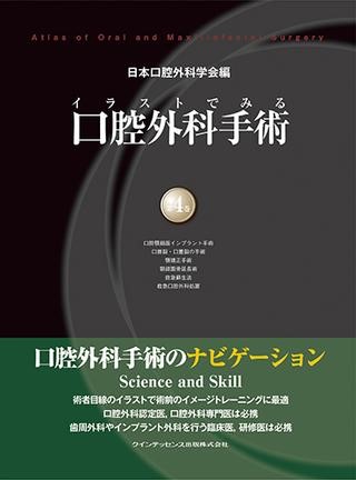楽天市場】イラストでみる口腔外科手術 第2巻の通販