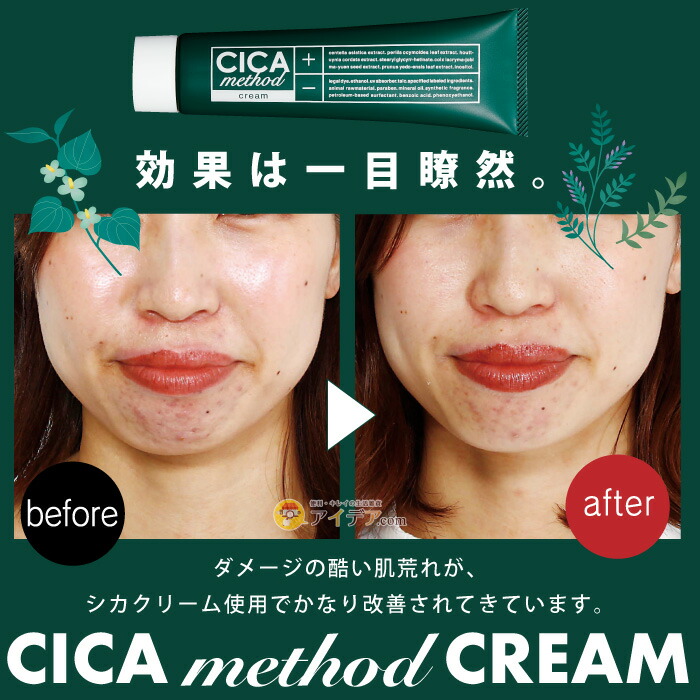 楽天市場】CICA フェイスクリーム 保湿 ジェルクリーム シカクリーム