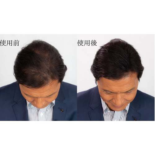 楽天24エクスプレス｜スーパーミリオンヘアー ダークブラウン 30g