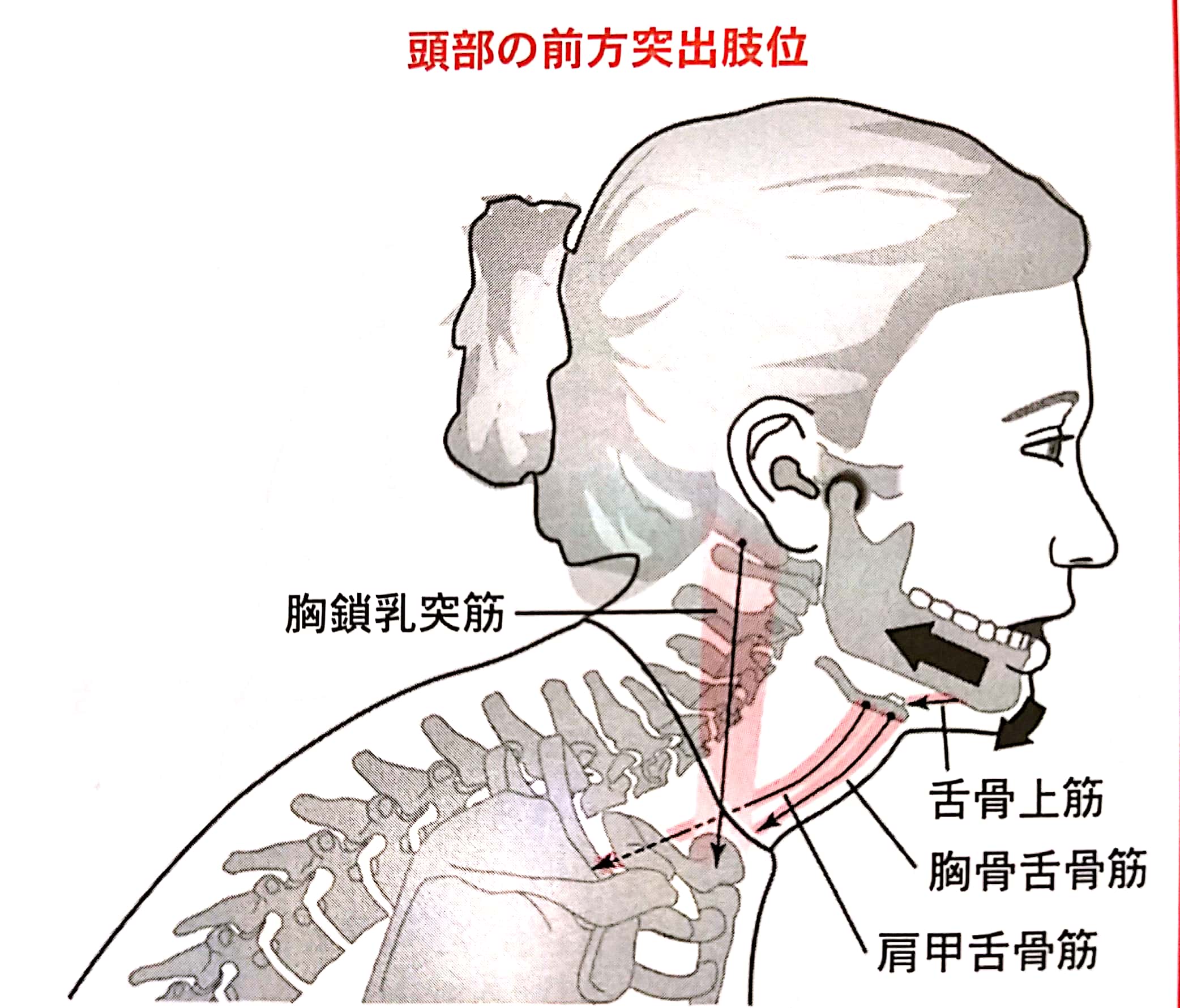 TMJ（顎関節）症候群 | ココから整体