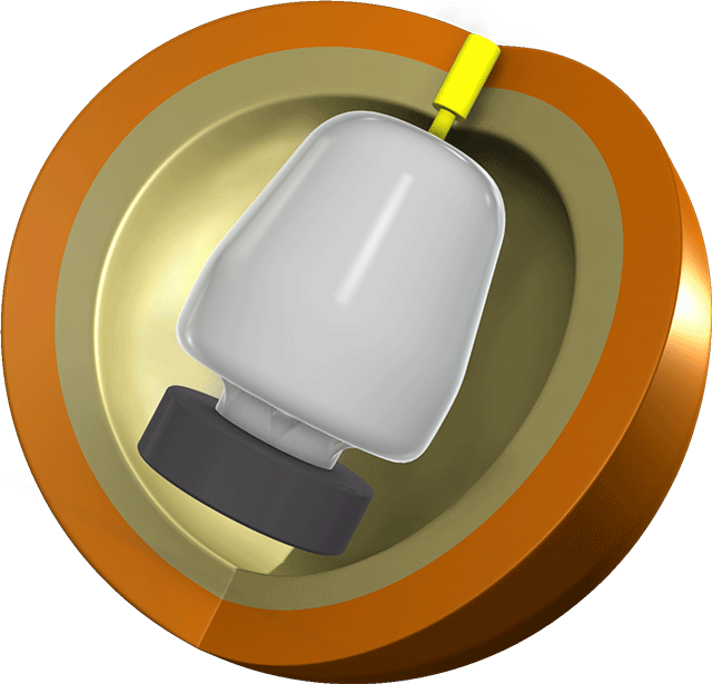 ABSオンライン ボール：プロアム・マジョリティ