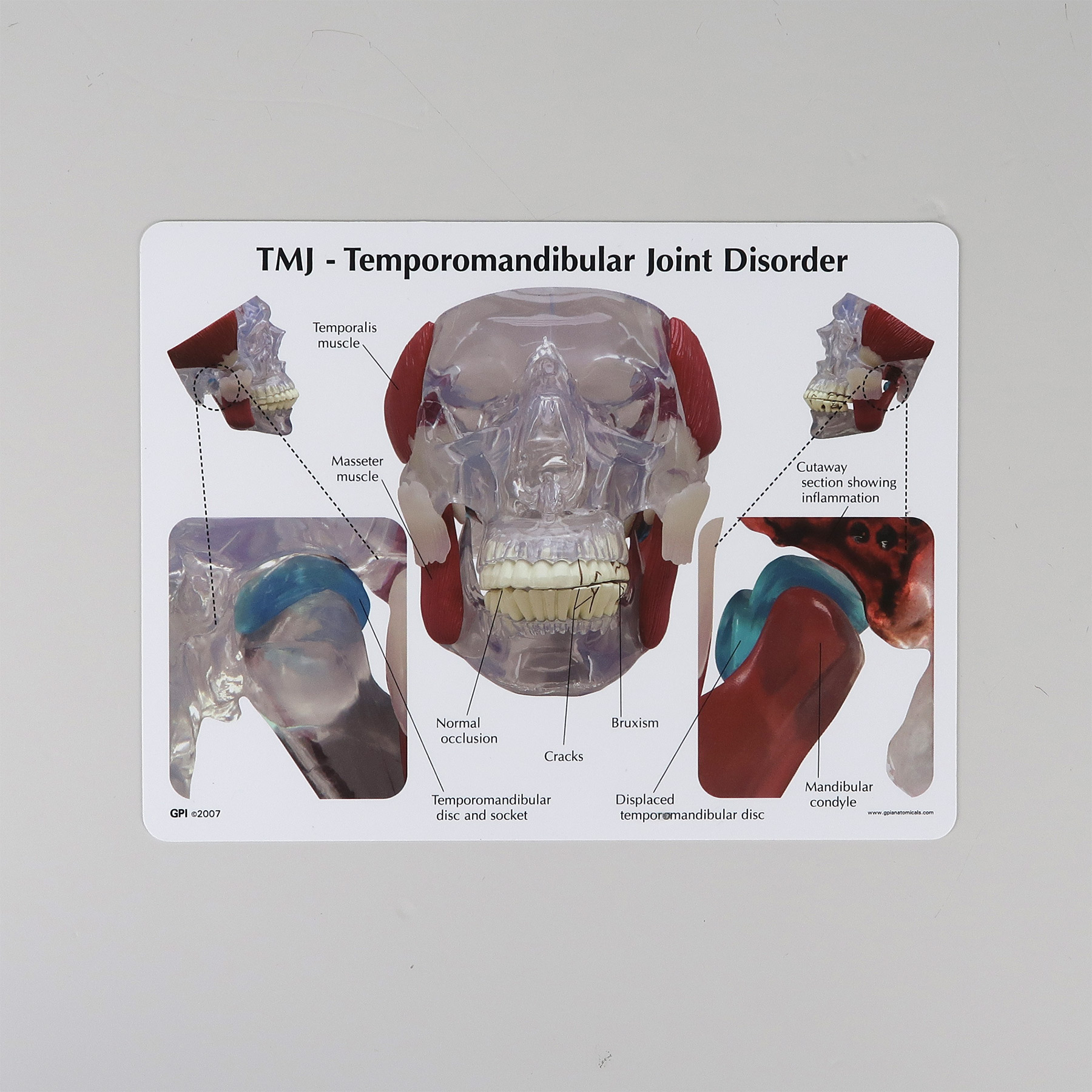 顎関節（TMJ）モデル | 日本スリービー・サイエンティフィック