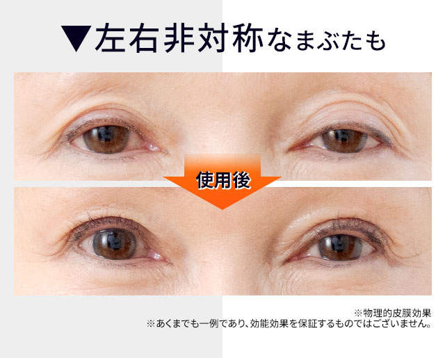 北の快適工房｜『リッドキララ』