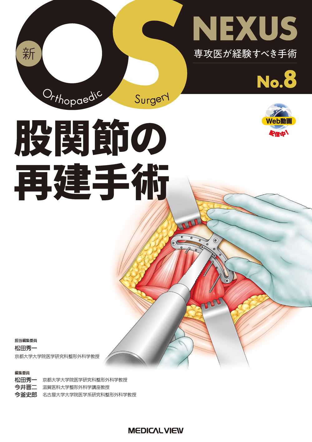メジカルビュー社｜整形外科｜新OS NEXUS No.8 股関節の再建手術［Web