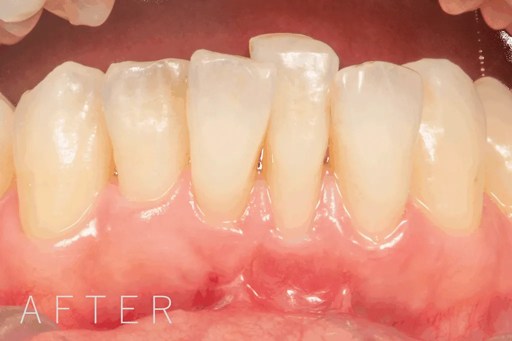 審美歯科・セラミック治療 - 野川デンタルオフィス浦和美園