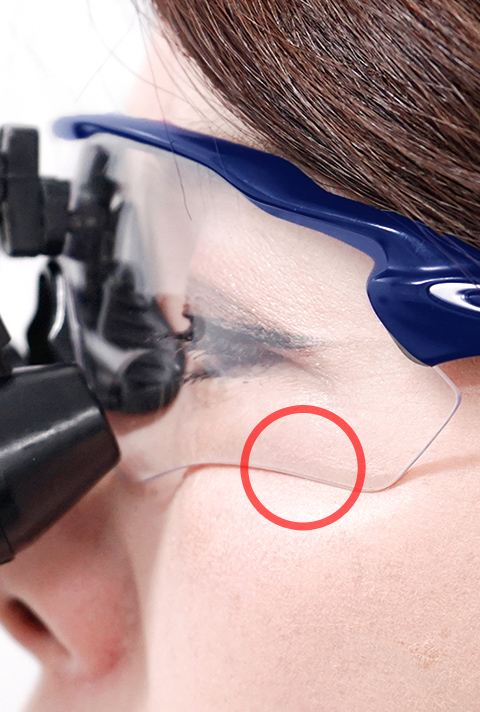 FINE LENS｜Surgitel～拡大鏡サージテル～歯科専用サイト