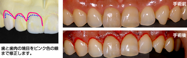 ルネス青山デンタルクリニック｜表参道の歯科・審美治療－2009年