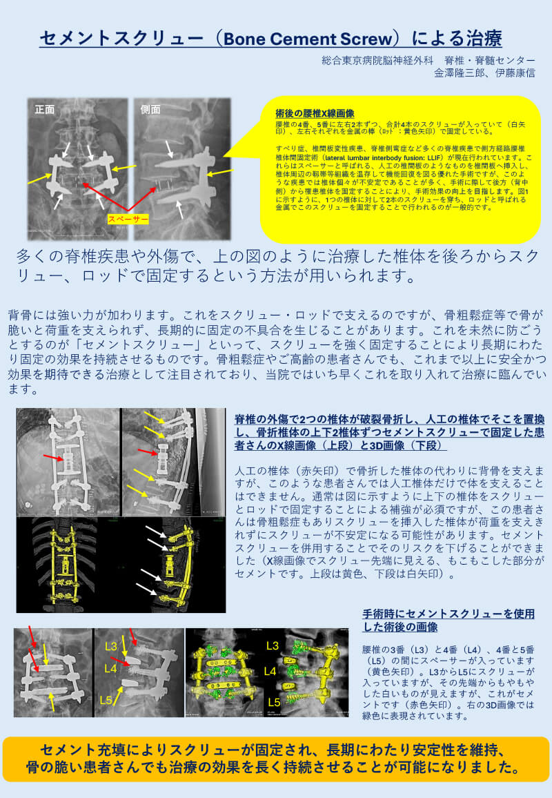 脊椎脊髄センター（脊椎脊髄外科）／脳神経外科 | 総合東京病院【公式