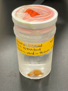 独自スタイルな珍渦虫ライフ ～未知の生き物の生き様に迫る～ | 筑波