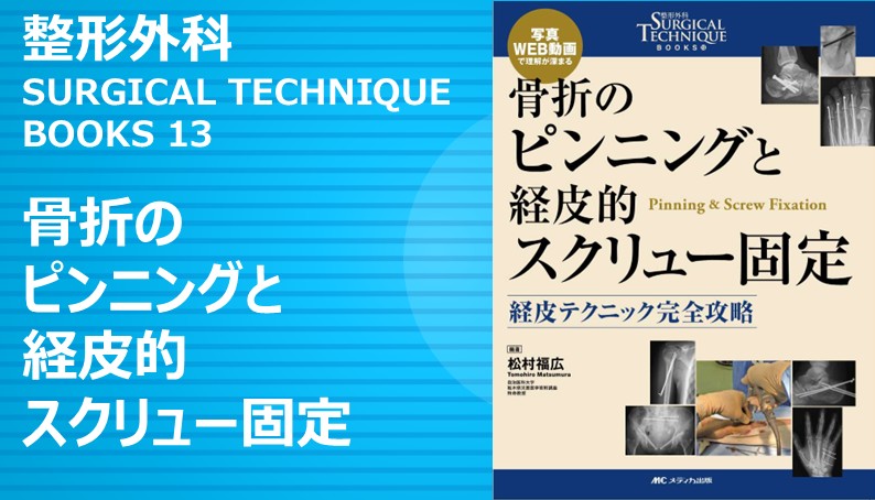 整形外科SURGICAL TECHNIQUE BOOKS 13 骨折のピンニングと経皮的