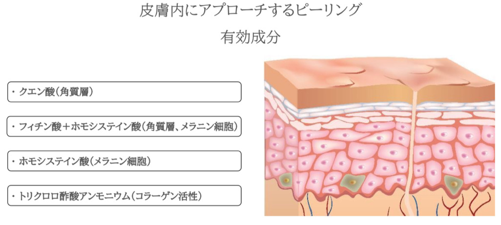 ワイコ水光ピールとは？期待できる効果や導入費用について徹底解説