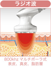 セルライトゼロ ネオ（本体/備品）【美容痩身に必要な機能が