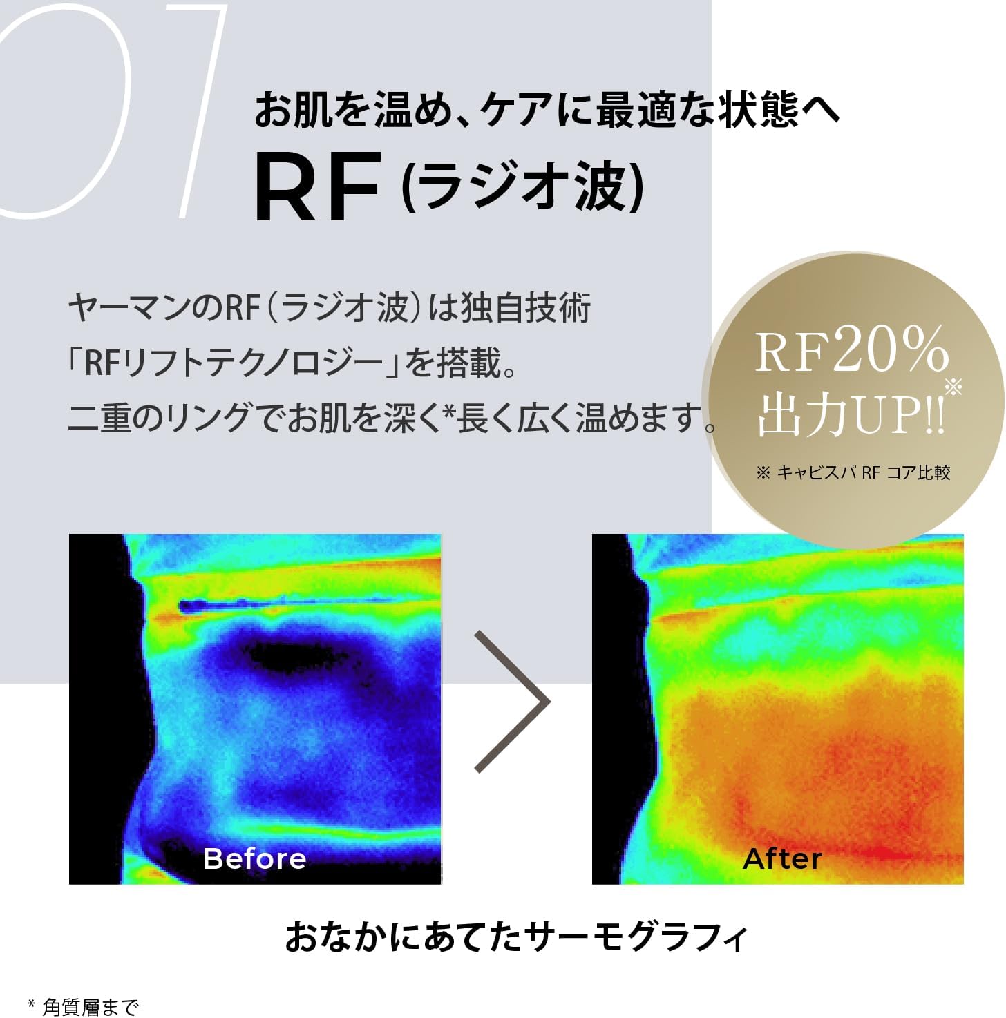 月額5,000円レンタルプラン：ヤーマン（YA-MAN)キャビスパRFコア PLUS
