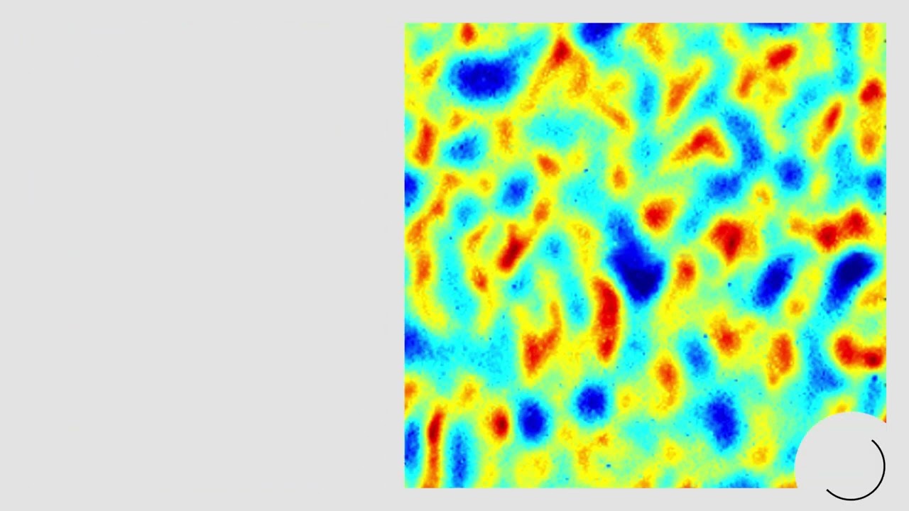 Anlon Maxi 18 cm - Anza Pro