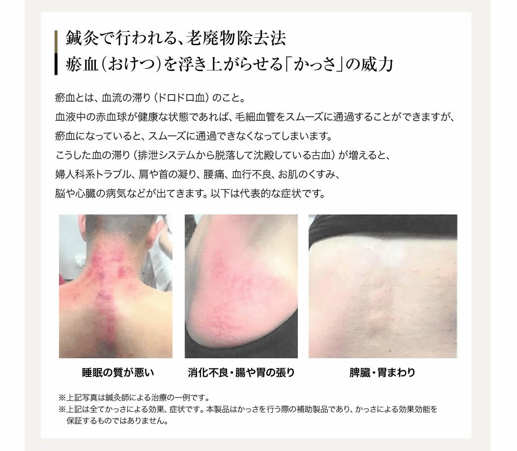 楽天市場】経絡温熱美容器 HEAT PHAGY（ヒートファジー）＜家庭用単体