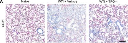CD31 Antibody (PECAM-1) (D8V9E) XP® Rabbit mAb | Cell Signaling