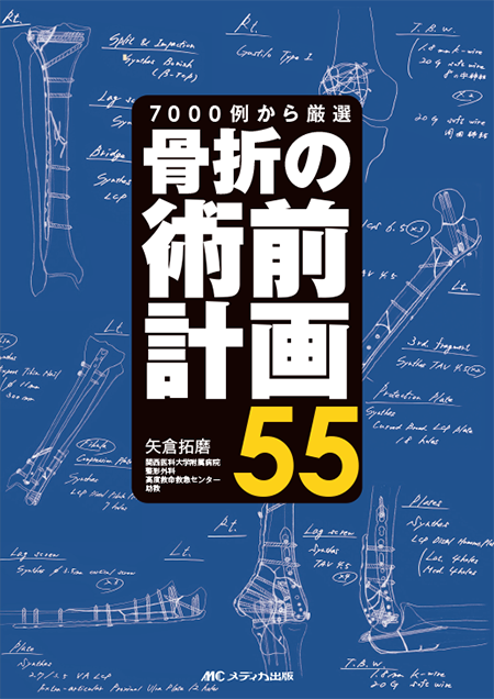 m3電子書籍 | 骨折 プレート治療マイスター 改訂第2版