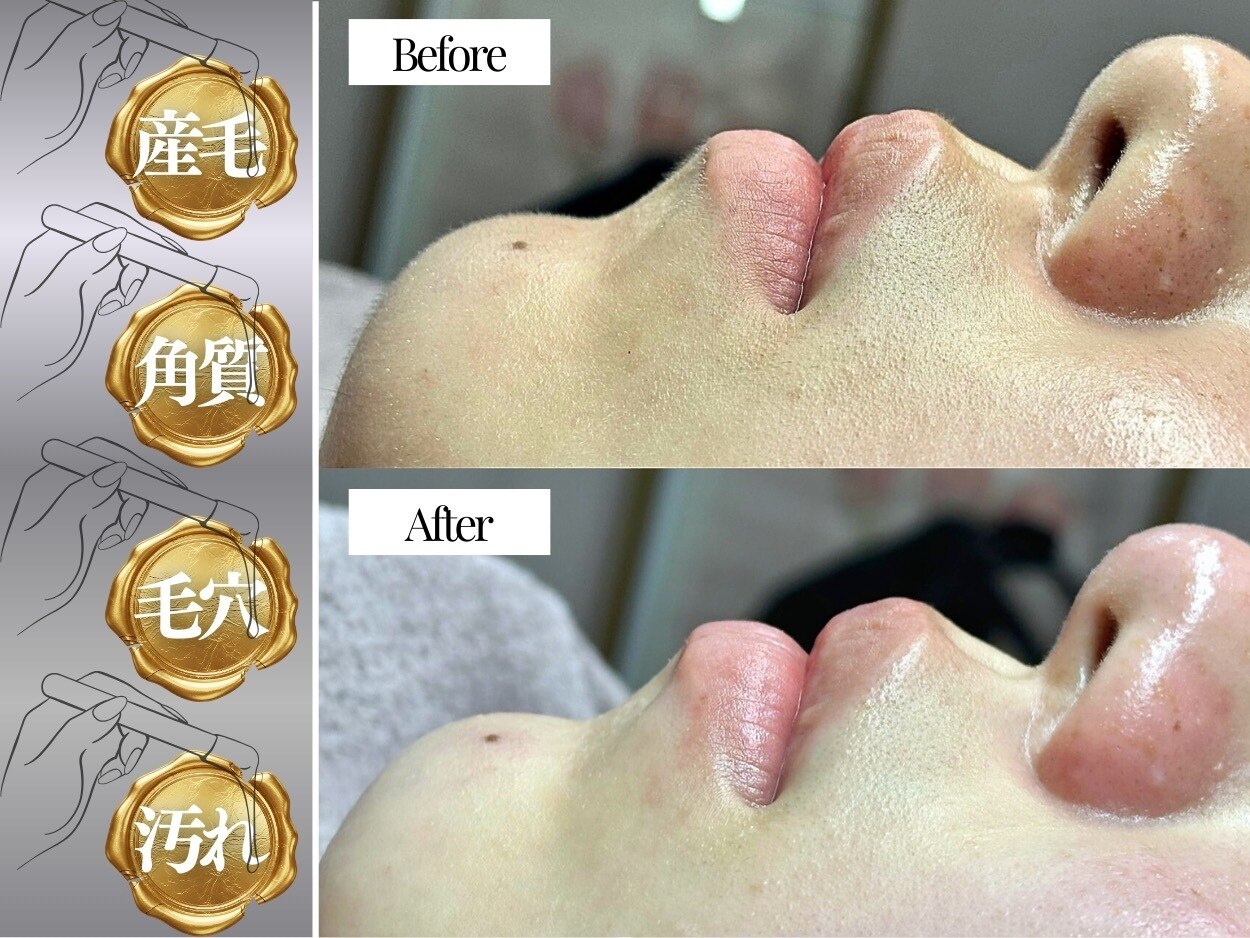 ホワイトワックス 浜松店(WHITE WAX)｜ホットペッパービューティー