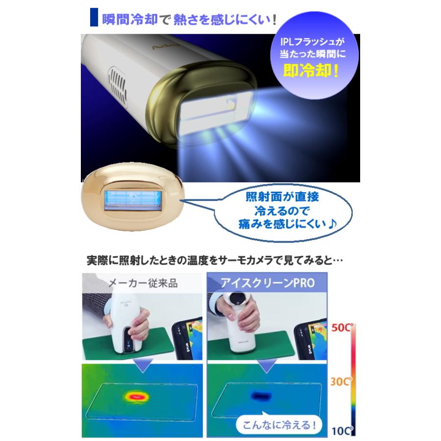 アデランス DoRAISEドゥライズ アイスクリーンPro ムダ毛ケア IPL光