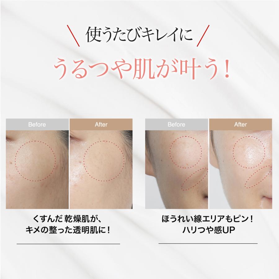b.glen（ビーグレン） ナイアシンアミド NMN配合 QuSomeモイスチャー