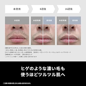 Amazon.co.jp: 【冷却機能付】パナソニック 脱毛器 光美容器 光エステ