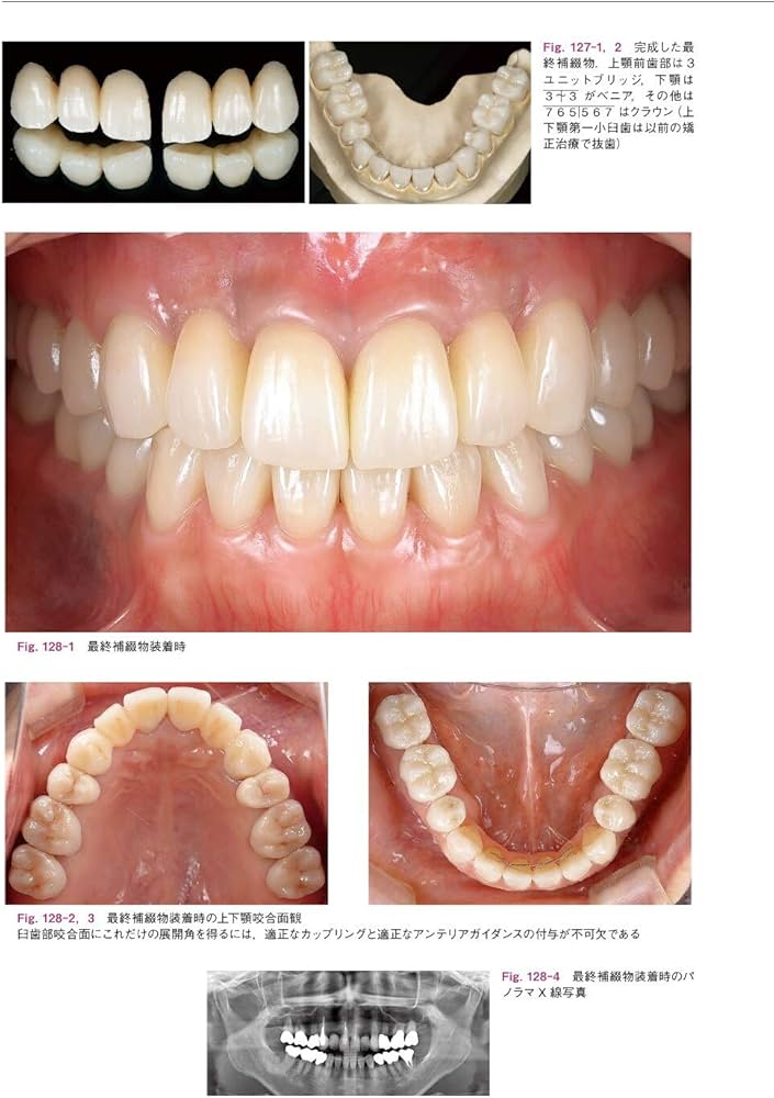 Amazon.co.jp: 包括的治療戦略 Vol.2 for Functional Management