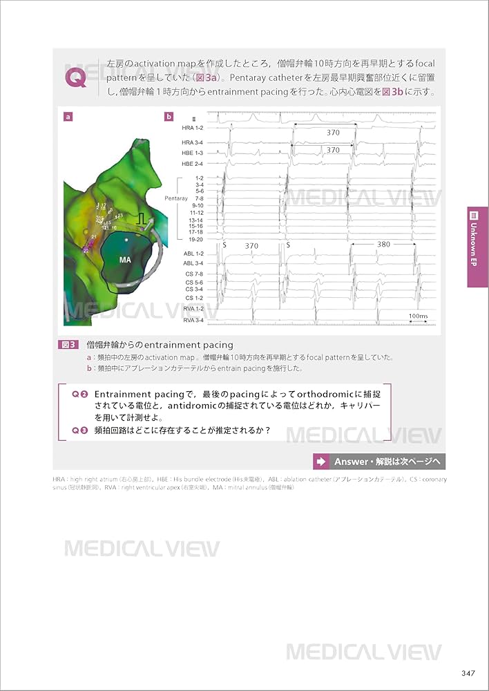 From Basic to Advanced EPS カンファレンスで学ぶ 心臓電気生理の
