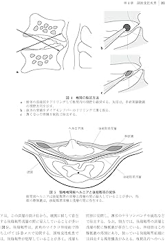 脊椎・脊髄疾患の外科 第2版 | 飛驒一利, 小柳 泉 |本 | 通販 | Amazon
