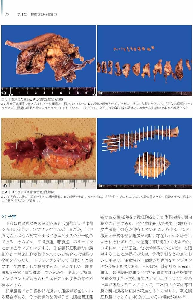 卵巣腫瘍・卵管癌・腹膜癌 改訂・改題第2版(腫瘍病理鑑別診断アトラス