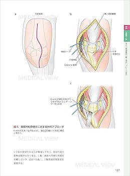 スタンダード骨折手術治療 上肢 | 渡部 欣忍 |本 | 通販 | Amazon