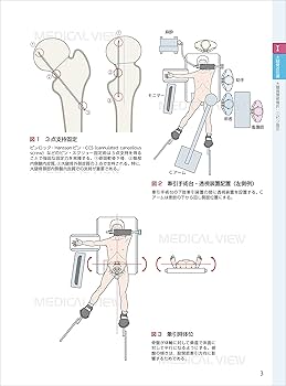 スタンダード骨折手術治療 下肢 | 渡部 欣忍 |本 | 通販 | Amazon
