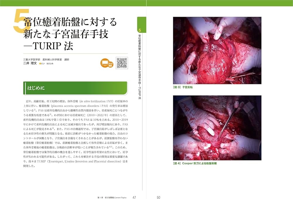 81LR15XKMSL._AC_UF1000,