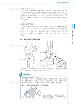 足部・足関節理学療法マネジメント−機能障害の原因を探るための臨床