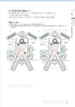 下部消化管癌に対する標準手術［Web動画付］−手技習得へのナビゲート