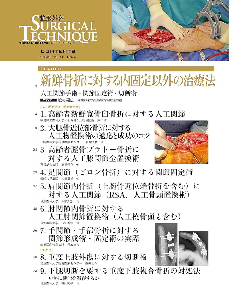 整形外科サージカルテクニック 2022年4号(第12巻4号)特集:新鮮骨折
