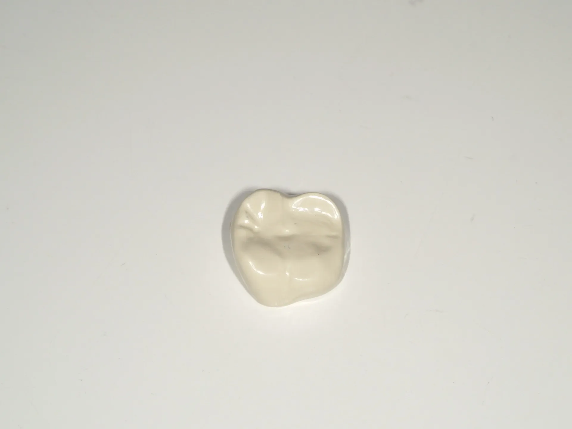 保険適応のPEEK冠 | ブログ | 市川市の妙典エリアの歯医者なら妙典歯科