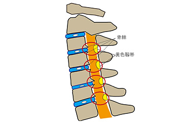 脊椎脊髄疾患 | 公益財団法人 唐澤記念会 大阪脳神経外科病院