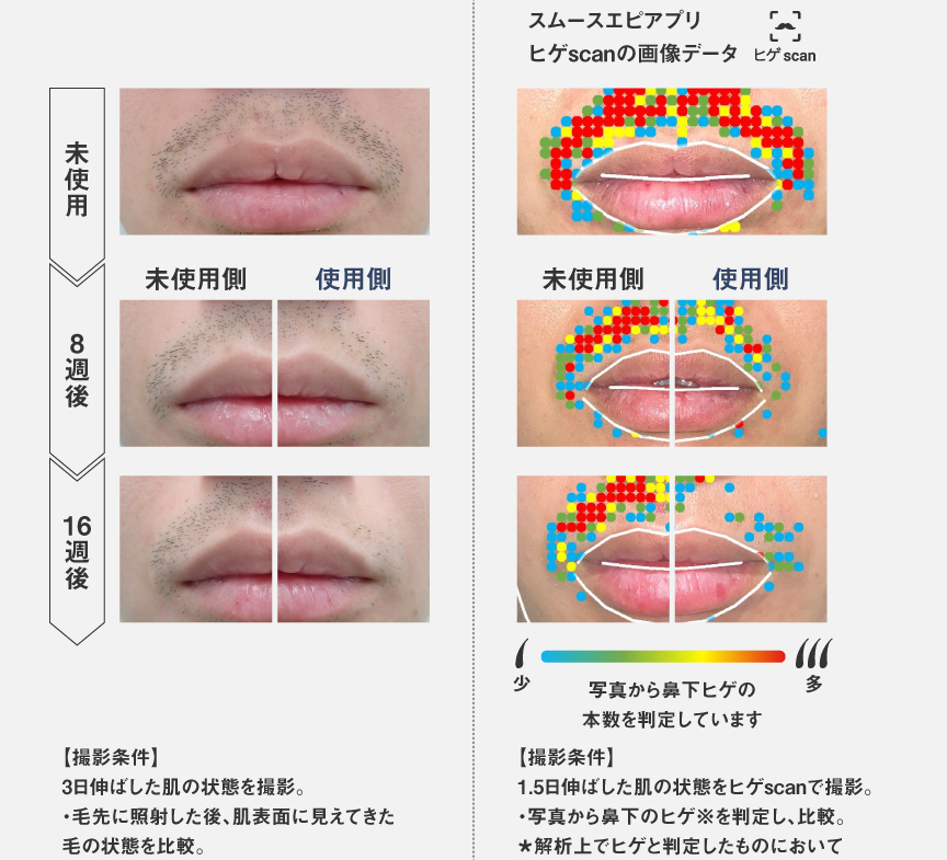 概要 スムースエピ パワー＆クール ES-WG0B | ボディケア（光エステ