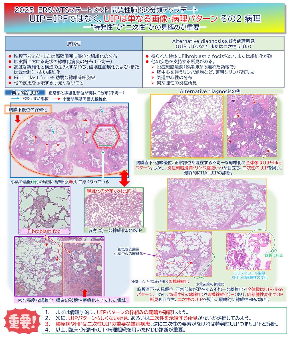 🫁新しい間質性肺炎の国際ステートメントその4‼️ Usual Interstitial