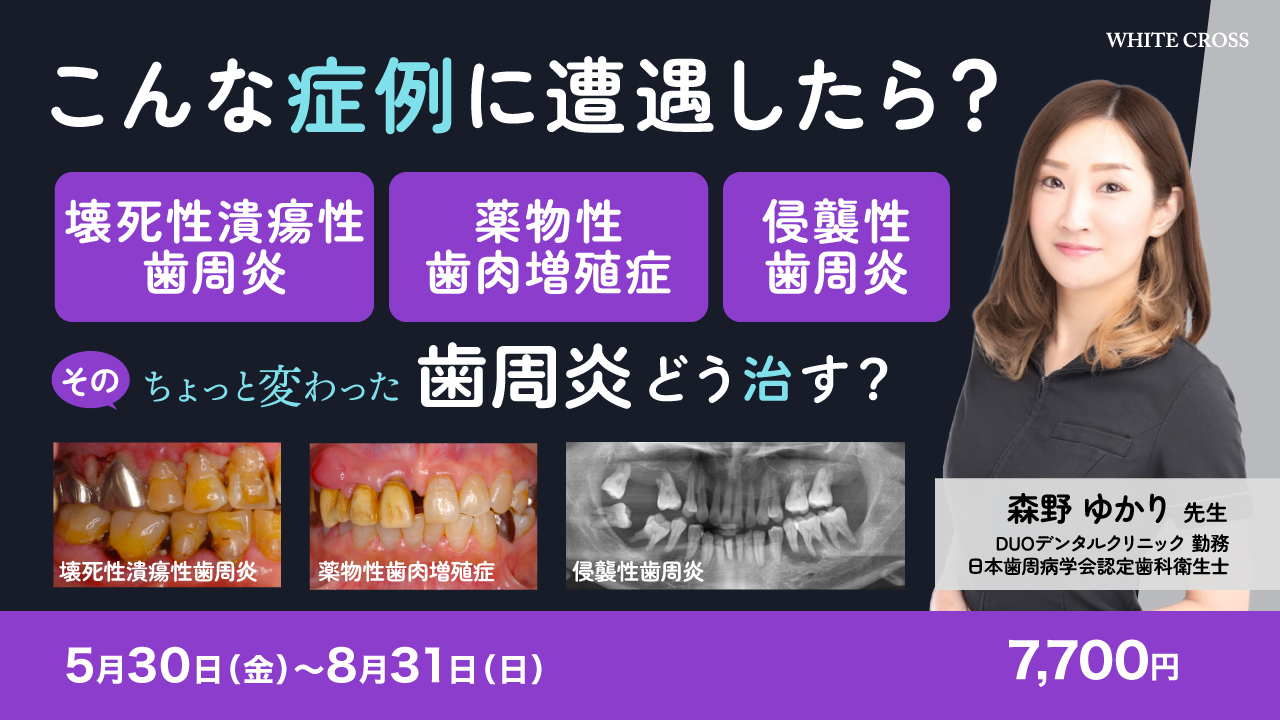 裁断済】 歯周炎ステージ1・2・3診療ガイドライン : Q&Aで紐解く! 裁断