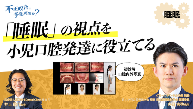 不正咬合は予防可能か？〜 睡眠の視点を小児口腔発達に役立てる