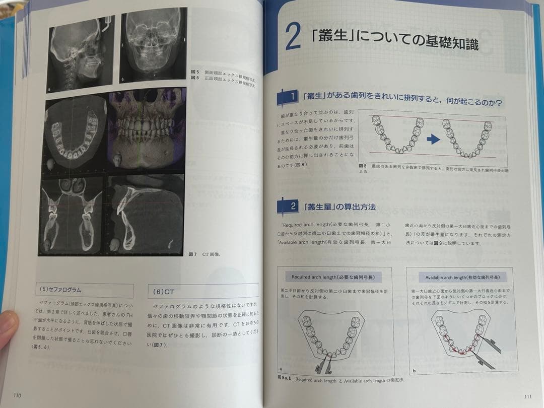 図解!矯正治療が面白いほどわかる本 : 基礎知識-セファロ分析-診断