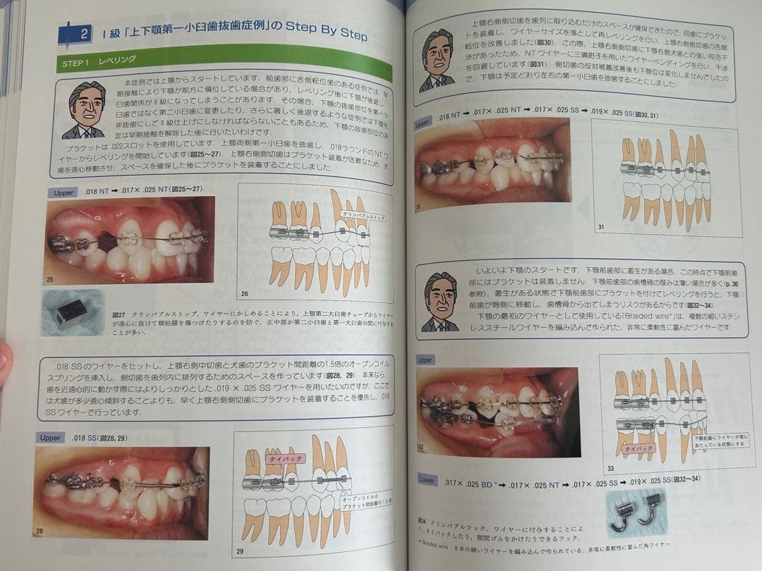 図解!矯正治療が面白いほどわかる本 : 基礎知識-セファロ分析-診断