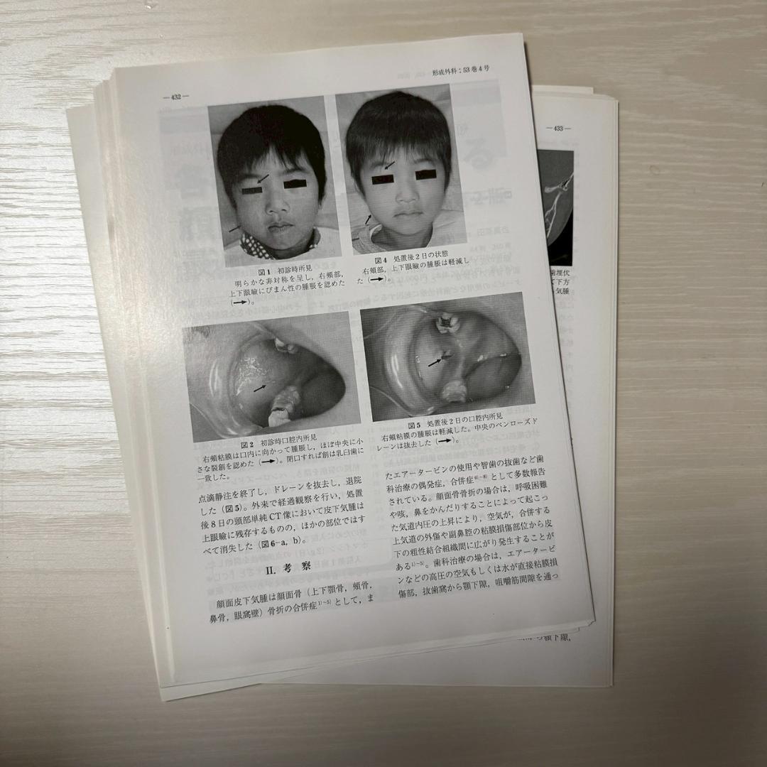 裁断済】形成外科 53巻 4号 皮弁による乳房再建後の二次修正術 - メルカリ