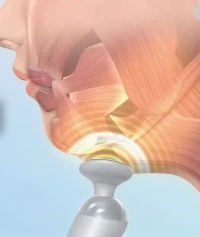 ルネサンス開発 StyllyFace EMS 美顔器 スタイリーフェイス