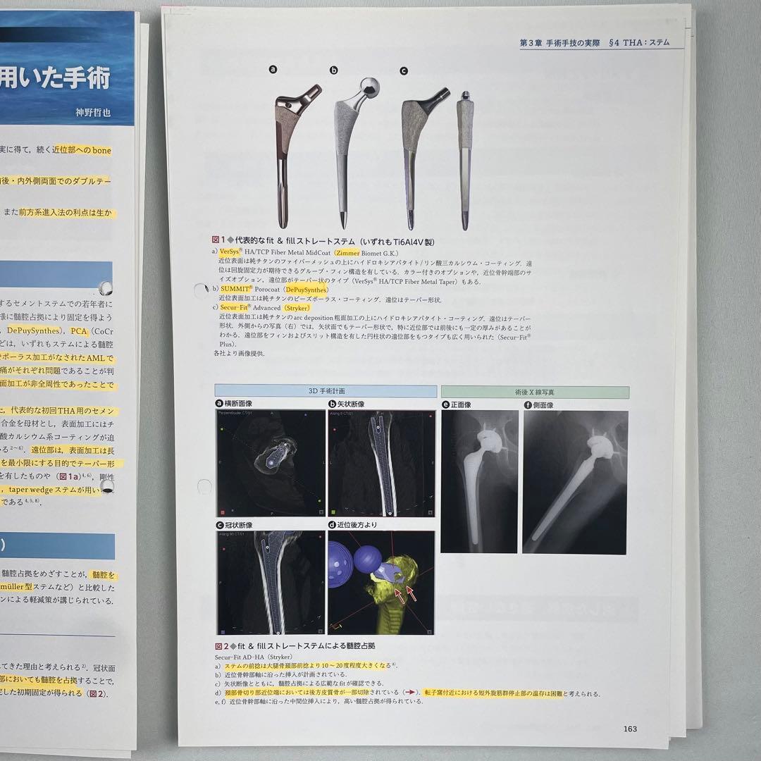 裁断済】BHA・THA 人工股関節置換術パーフェクト - メルカリ